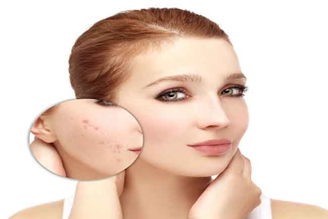 सेंसिटिव स्किन की देखभाल